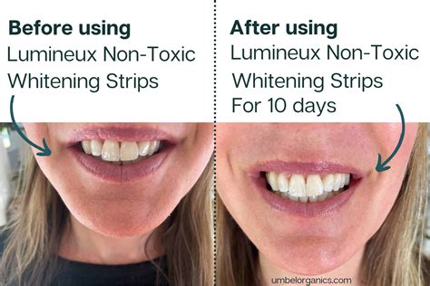 lumineux teeth whitening reviews|do lumineux whitening strips work.